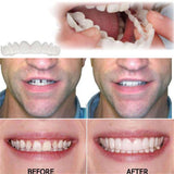 Whitening Braces Simulation Teeth Denture Brace